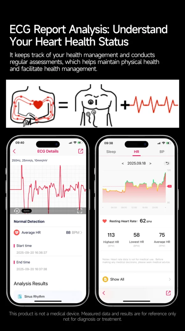 S4f00e61b44d8467198b2fb8848b61b24e-1.webp 2026 New Accurate Blood Lipid Uric Acid Test Smart Watch Men Women ECG Blood Pressure Body analysis Voice Call Health Smartwatch